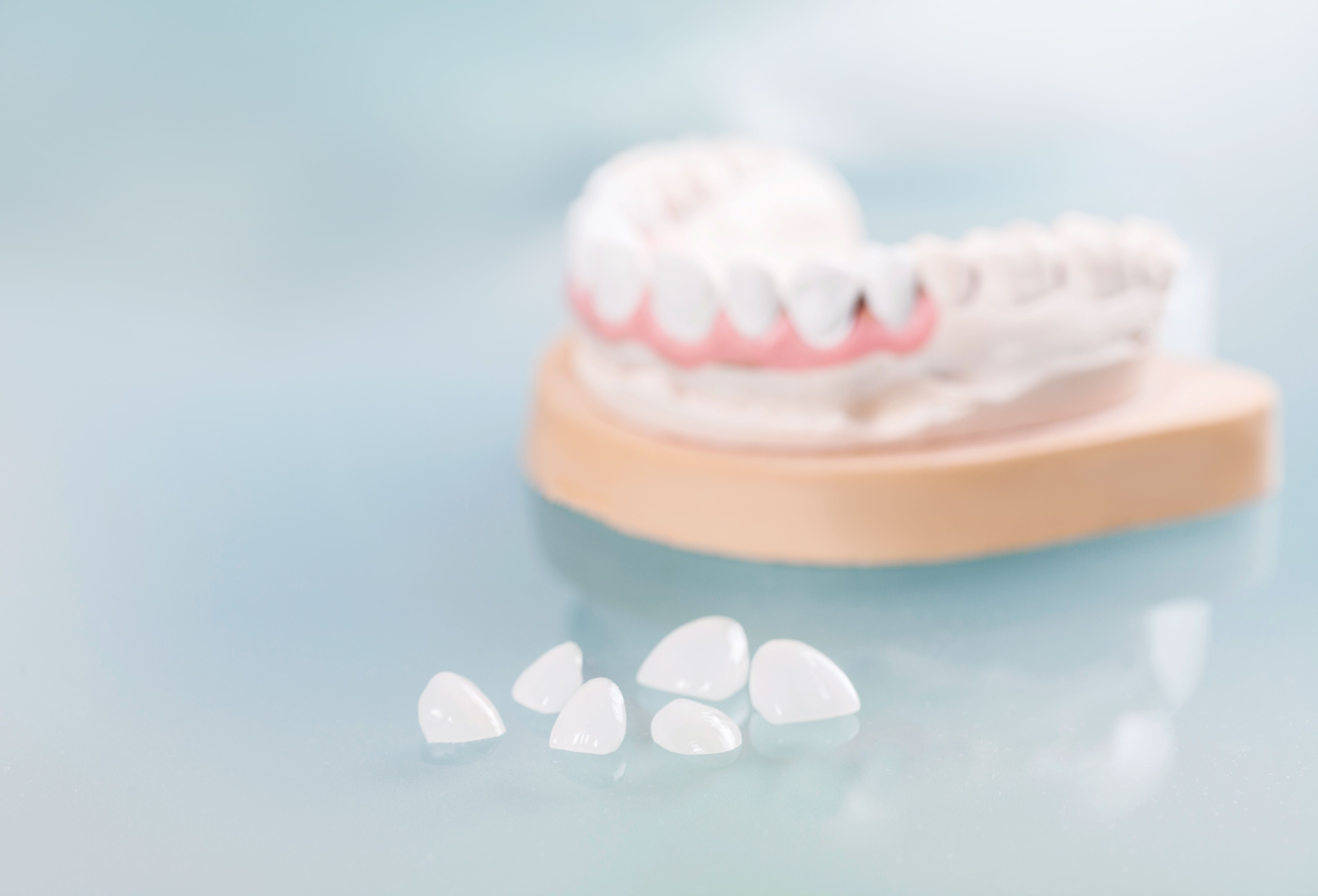 veneers and crowns
